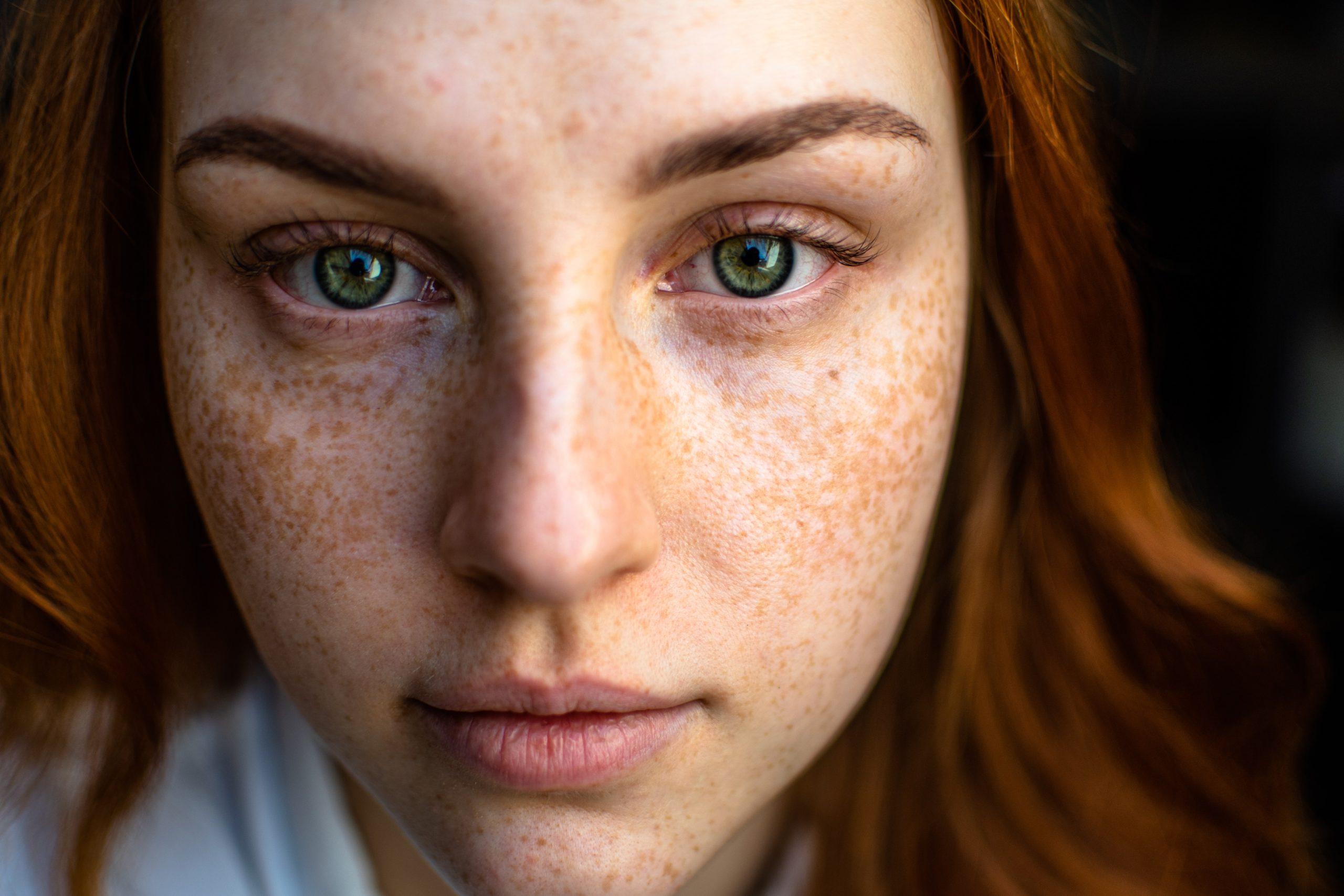 Here’s What’s Causing Acne on Every Part of Your Face