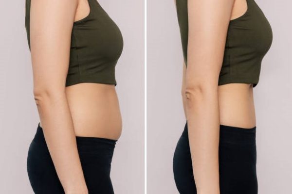 10 Pounds in 2 Weeks - Weight Loss Bundle - Image 4